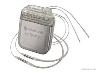 Deep Brain Stimulation (DBS) Part 4: My Journey to an Electric Brain ...